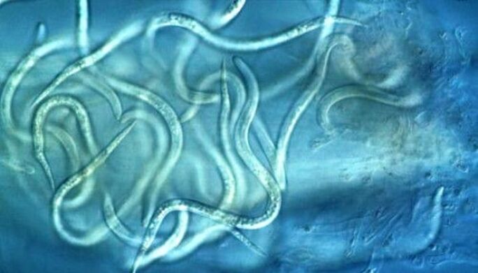 How nematode parasites appear in the human body