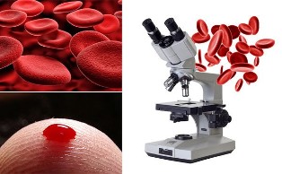 hemo scanning is blood